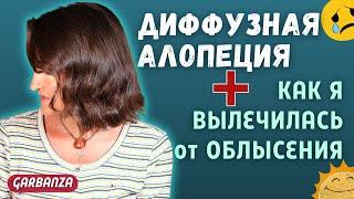 Диффузная алопеция. Лечение выпадения волос