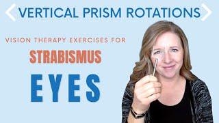 Vertical Prism Rotations: Vision Therapy Exercise for Strabismus or Lazy Eye