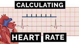 Calculating Heart Rate on an ECG | EKG | OSCE Guide | UKMLA | CPSA