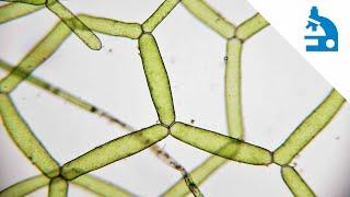 Algae Corner: "What Is It?" - Water Net / Hydrodictyon