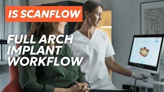 DEXIS™ IS ScanFlow - Full Arch Implant Workflow