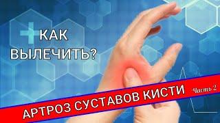 АРТРОЗ СУСТАВОВ КИСТИ. Лечение (Часть 2)