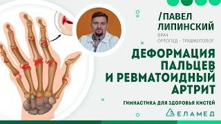 Деформация пальцев и ревматоидный артрит. Гимнастика для здоровья кистей | Павел Липинский