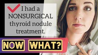 NONSURGICAL alternative to thyroidectomy: My experience with Thyroid RFA (July 2019)