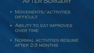 Pancreatic Cancer Patients Guide: 7 - Surgery