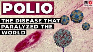 Polio: The Disease that Paralyzed the World