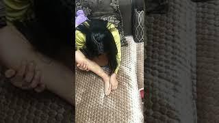 Chinese RAK amputee one leg teenage girl massaging her damaged big toe