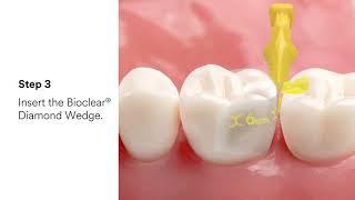 3M™ Filtek™ Dental Restoratives and Bioclear®