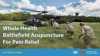 What is Battlefield Acupuncture - VA Northeast Ohio Healthcare System