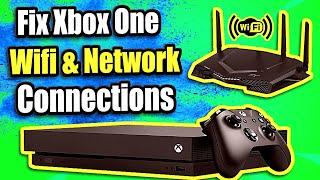 FIX XBOX ONE not connecting to WIFI and Network Issues  | (5 Steps and More)