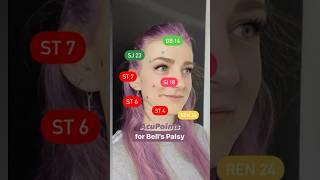 Acupuncture Points for Bell’s Palsy 