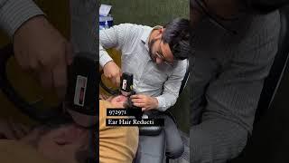 Getting hair removed from ears after plastic surgery #hairremoval #shorts #laser #hair #skincare