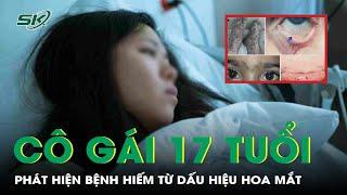 Tưởng hoa mắt do thiếu máu, cô gái 17 tuổi bàng hoàng phát hiện mắc hội chứng Evans hiếm gặp | SKĐS