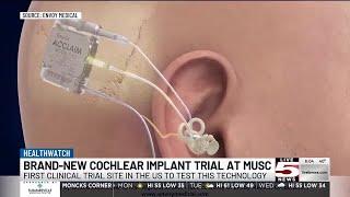 VIDEO: MUSC first in country to lead a brand-new cochlear implant trial