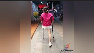 The beautiful woman has an amputated leg and life with one leg #disabled #amputada