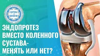  Эндопротез коленного сустава - менять или нет?