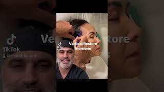 Dr. Amir Karam REVEALS Vertical Restore Facelift Incision Design!