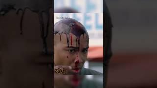 He has been shot in the head | The rookie #therookie #series #thirtythree #shorts