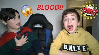 Sour Candy Challenge...............HE'S TOUNGE STARTED BLEEDING!!!!!!!!!