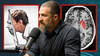 How Your Brain Changes When You Take A Break From Porn - Andrew Huberman