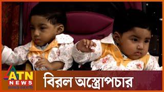 দেশে প্রথমবারের মতো হবে মেরুদণ্ড জোড়া লাগা জমজ শিশুর অস্ত্রোপচার | Twin Baby Surgery