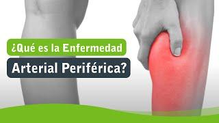 ¿Qué es la Enfermedad Arterial Periférica?