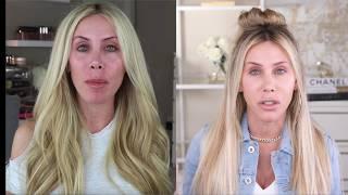 The REAL CURE to Your Skin Condition & How I "Cured" My Rosacea!