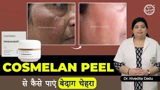 Cosmelan Peel for Pigmented Skin | Cosmelan Peel Treatment | Dadu Medical Centre