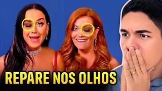 FAMOSOS APARECEM COM MARCAS ESTRANHAS NOS OLHOS - O Que é Isso?