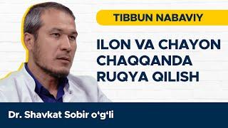 ILON VA CHAYON CHAQQANDA RUQYA QILISH | TIBBUN NABAVIY @REGISTONTV