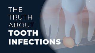 The Truth About Tooth Infections