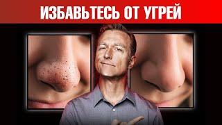 Как НАВСЕГДА избавиться от черных угрей и сальных нитей? 