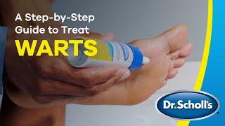 Dr. Scholl's | How To Use Freeze Away® Wart Remover