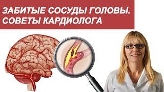 Забитые сосуды головы. Советы кардиолога