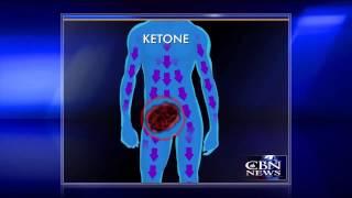 生酮飲食（Ketogenic Diet）抗癌 Starving Cancer