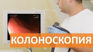 Колоноскопия. Колоноскопия под наркозом