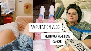 Amputation Vlog- fighting a rare bone cancer