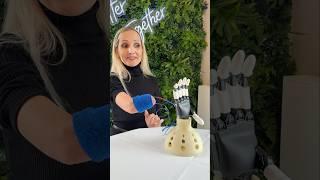 so happy to have a prosthetic arm  #motivation #HolidaysWithYouTube