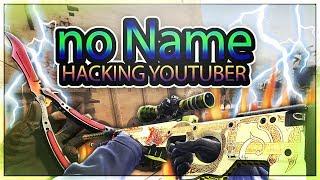 HOW TO GET NO NAME IN CSGO Hacker!!!!!