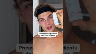 Calm the redness, reclaim your confidence with The Red Rescue!  #rosacea #redness
