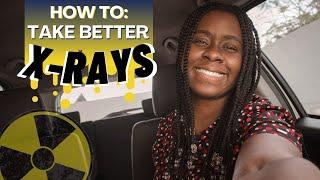 how to take better x-rays || Ask The Rad Tech