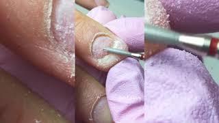nail sunny tutorial- Torn or Detached Nail Treatment 