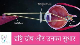 दृष्टि दोष और उनका सुधार | Defects of Vision and their correction | Hindi