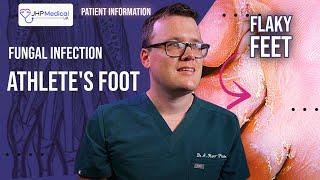 DOCTOR Explains ATHLETE'S FOOT | Fungal Foot Infection - Itchy Flaky Feet | Tinea Pedis