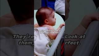 Conjoined twins have three kidneys when they are together, but only two after they are separated!