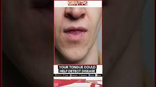 Your tongue could help detect disease | Gravitas | WION Shorts