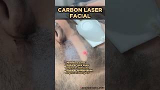 Skin Glow Laser | Carbon Laser Facial | Carbon Laser Treatment | Carbon Peel | Skin Clinic Delhi