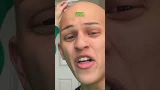 I get eyebrows (finally) #comedy #funny #alopecia #makeup