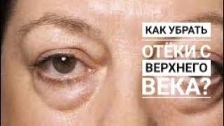 Как снять отек с верхнего века?