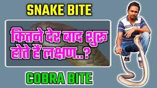 Snake Bite के कितने देर बाद शुरू होते हैं लक्षण | Cobra Bite | Cobra Snake